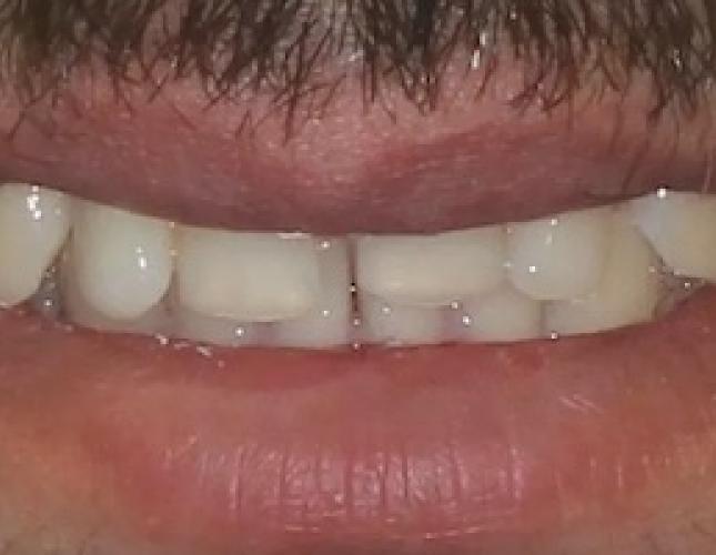 Case 4 before Case 4 before