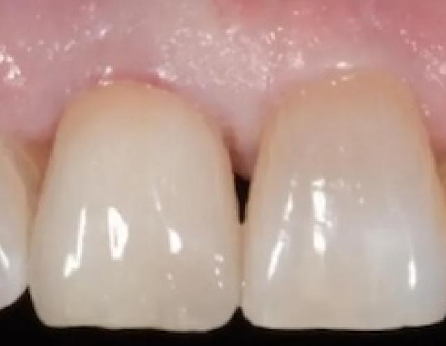 Case 7 after Case 7 after