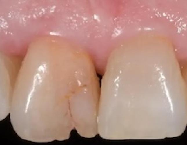 Case 7 before Case 7 before