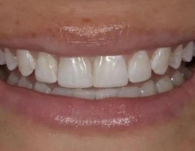 Case 8 after Case 8 after
