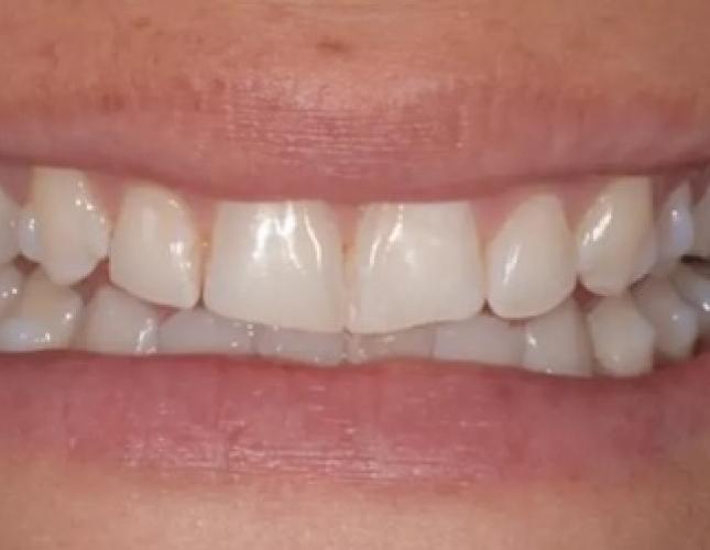 Case 8 before Case 8 before