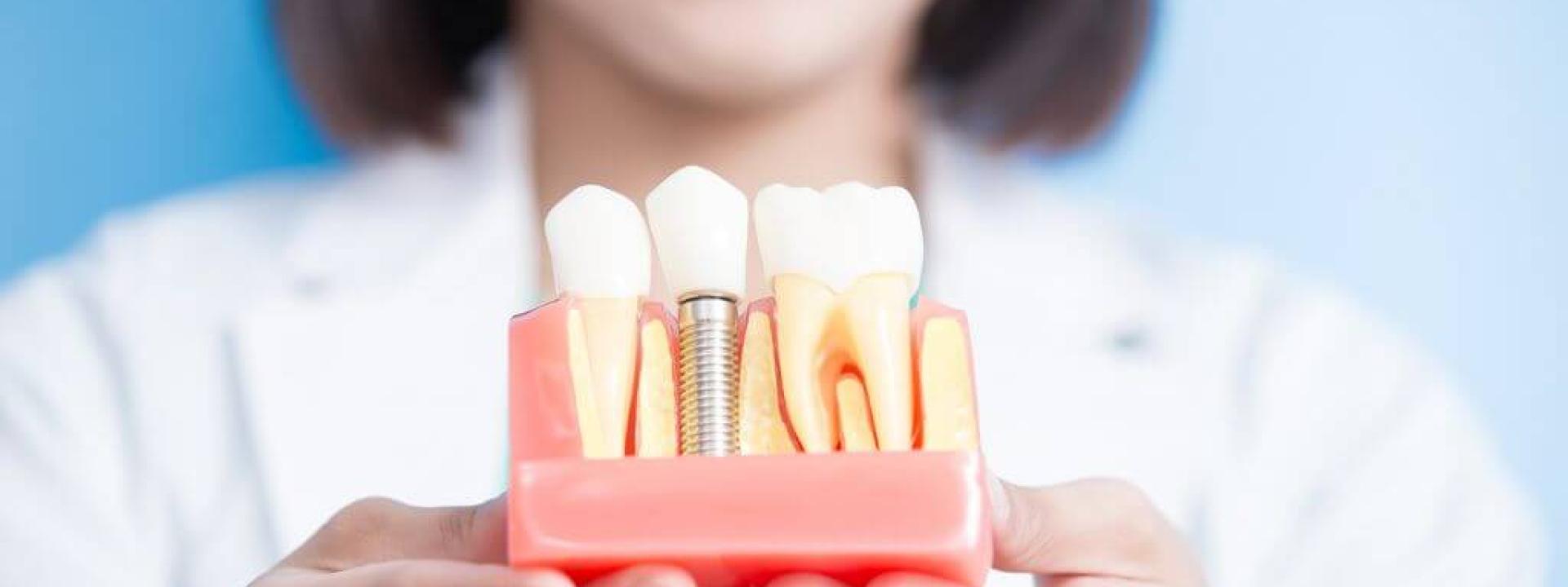Addressing Failed Implants